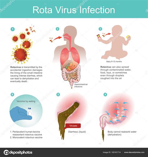 rotavirus sintomas-1